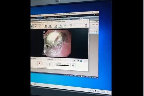 Sản phụ mới sinh con suýt mất mạng do nuốt mật lợn