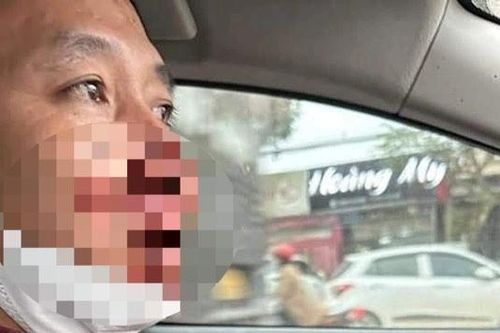 Thầy giáo bị kẻ xấu chặn đường hành hung, cướp tiền trên đường đi dạy về