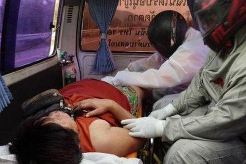 Cặp vợ chồng bị 10.000 con ong đốt
