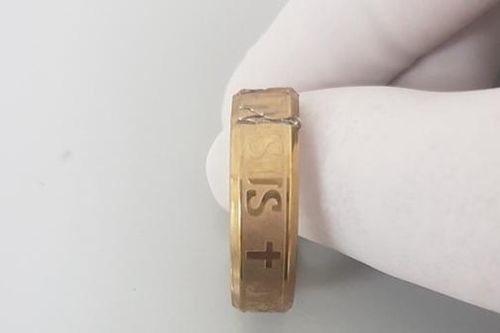 Thanh niên 27 tuổi suýt bị hoại tử 'của quý' vì đeo nhẫn tạo khoái cảm