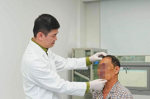 Bóc tách khối u như chùm nho trên mặt người đàn ông suốt 20 năm