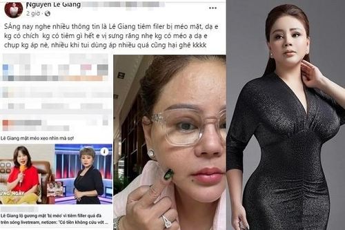 Lê Giang khoe nhan sắc thật bác tin đồn tiêm filler bị méo mặt