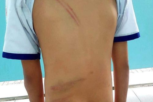Kiên quyết xử lý vụ mẹ kế ở Cà Mau đánh con chồng dã man