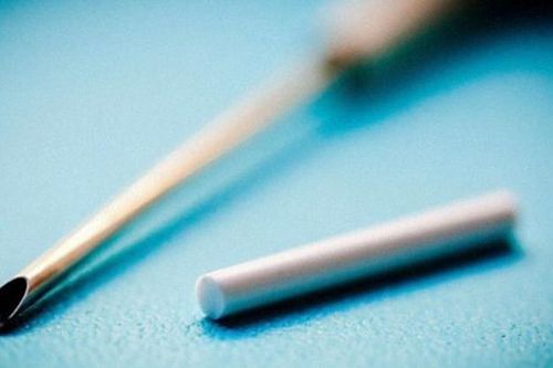 Đau mỗi lần cử động vì que cấy tránh thai 'đi lạc' vào cơ