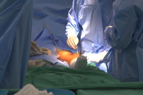 Ca thay khớp tăng trưởng đầu tiên tại Việt Nam cho bé 9 tuổi mắc ung thư xương