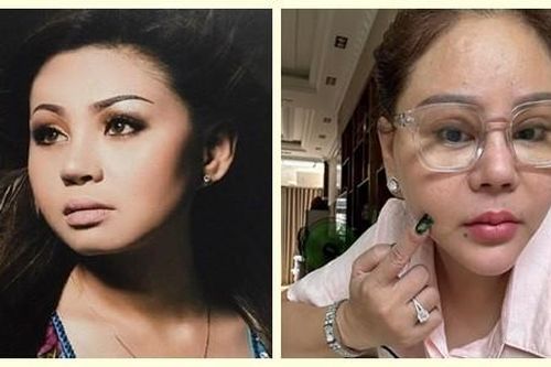 Lê Giang phủ nhận tiêm filler 'méo mặt', từng mê dao kéo thế nào?