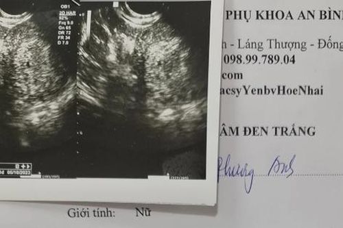 Vụ người phụ nữ bị đánh sảy thai khi đi ăn tối: Nếu xác định được hành vi có tính chất côn đồ thì sẽ bị xử lý hình sự