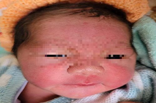 Bé trai sơ sinh nặng 3,5 kg bị bỏ rơi ở vùng thôn quê Thừa Thiên - Huế