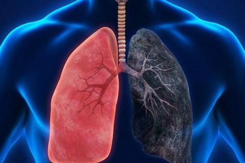 Các tác dụng phụ thường gặp khi điều trị ung thư phổi