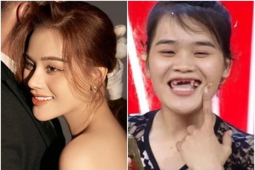 'Thánh sún' Ngân Thảo gây bất ngờ với diện mạo trong ngày cưới
