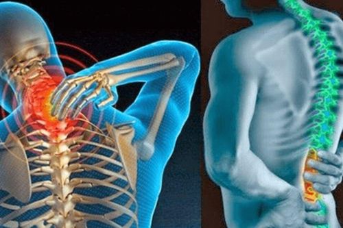 Dấu hiệu ung thư xương giai đoạn đầu