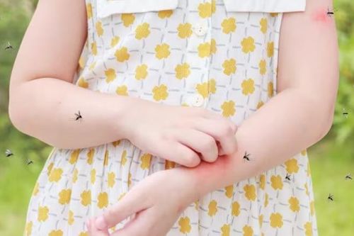 Mẹo bảo vệ con khỏi muỗi đốt khi thời tiết nóng ẩm