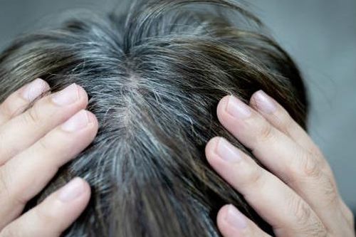 Tóc bạc sớm có phải do 'máu xấu'?