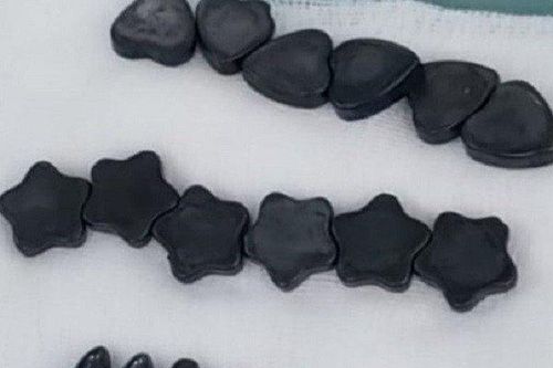 Bé trai 10 tuổi nuốt 20 viên nam châm vì tưởng là kẹo ngọt