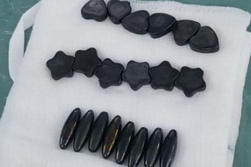 Bé trai 10 tuổi nuốt 20 viên nam châm vì nghĩ là kẹo