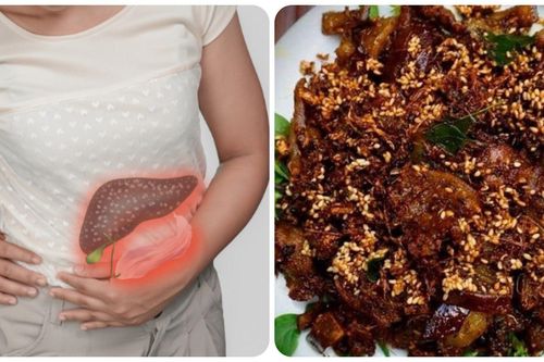 Người bị bệnh gì không nên ăn thịt chó?