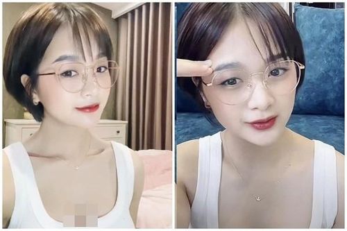 Lộ vòng 1 to bất thường, 'thánh nữ bi-a' bị nghi 'dao kéo'