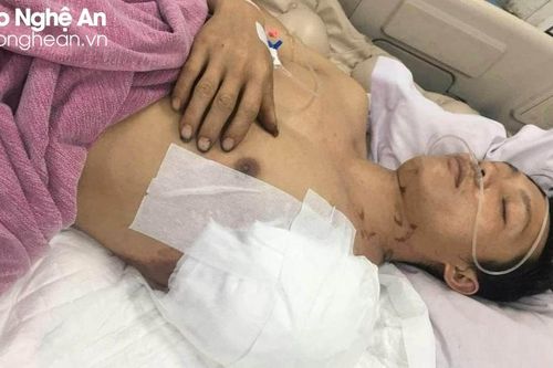 Gia cảnh khó khăn của người đàn ông bị máy cuốn đứt lìa cánh tay
