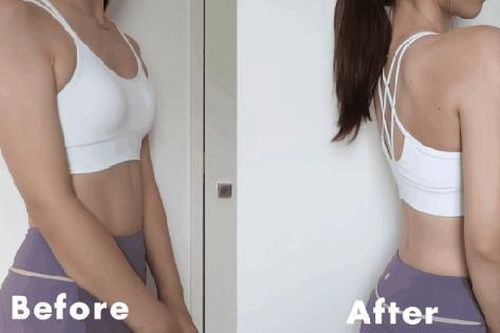 6 động tác cải thiện bắp tay nhiều mỡ thừa