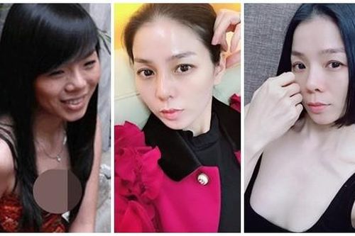 Nhan sắc Lệ Quyên thời chưa nâng mũi và sau 5 năm tháo sụn