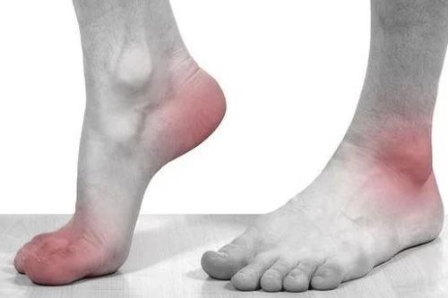 5 dấu hiệu ở chân cảnh báo bệnh nguy hiểm: Ai không có thật đáng chúc mừng