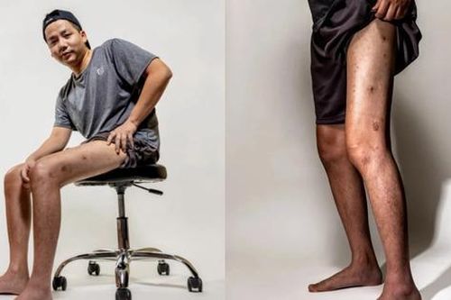 Đôi chân dài trị giá 5 tỷ của Khoa Pug xuất hiện trên fanpage của tạp chí nổi tiếng