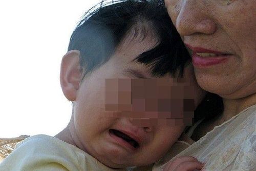 Ngủ ngáy, thở miệng, vào viện khám bé trai bỗng bại não