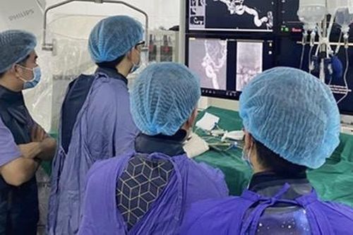 Chủ quan với triệu chứng đau đầu, nữ bệnh nhân tử vong vì vỡ mạch máu não