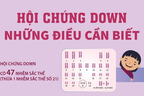 Những điều cần biết về hội chứng Down ở trẻ em