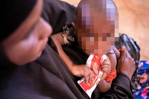 Hơn 20.000 trẻ em bị tử vong ở Somalia do hạn hán trong năm 2022