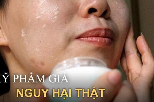5 hệ lụy đáng sợ khi dùng mỹ phẩm kém chất lượng