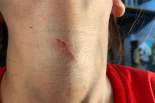 Cô gái 17 tuổi phải đối diện với cảnh kinh hoàng sau câu nói 'tao vã lắm rồi' của gã thanh niên