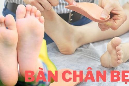 4 việc cha mẹ cần làm để giảm nguy cơ con bị bàn chân bẹt