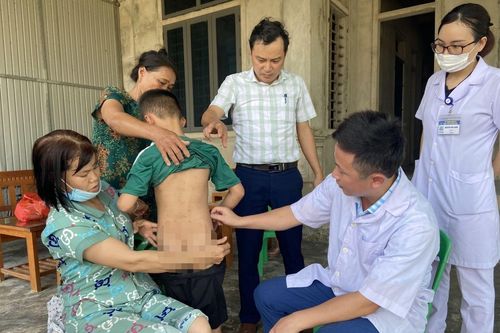 Lý do khiến hơn 120 người dân Hà Tĩnh bị nổi sẩn ngứa