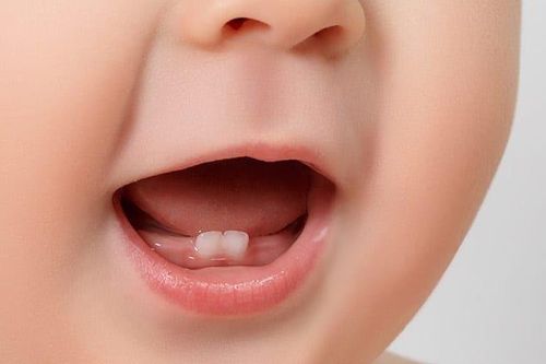 Vệ sinh răng miệng đúng cách cho trẻ trong độ tuổi ăn dặm