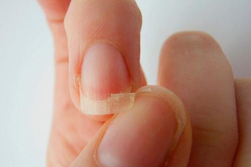 Thấy biểu hiện này coi chừng cơ thể thiếu sắt