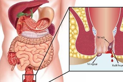 4 bài tập kích thích nhu động ruột, hỗ trợ bệnh trĩ không tăng nặng