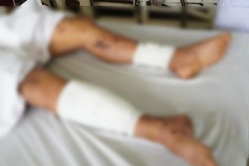 Đắk Lắk: Tự chế pháo nổ tại nhà, 2 nam sinh thương vong