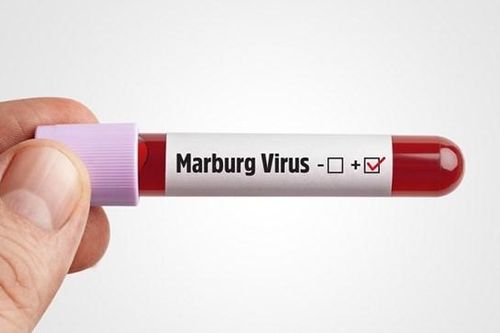 Chủ động phòng bệnh Marburg