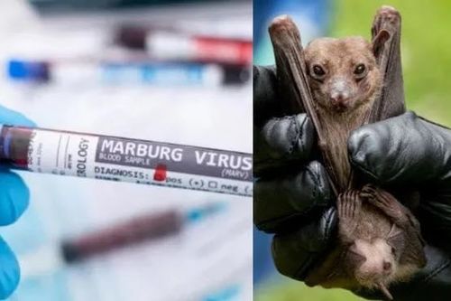 Bệnh do virus Marburg lây nhiễm thế nào?