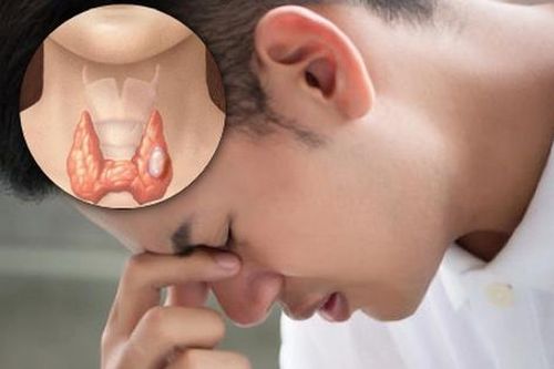 Tưởng đau đầu do mất ngủ, ai ngờ mắc ung thư tuyến giáp