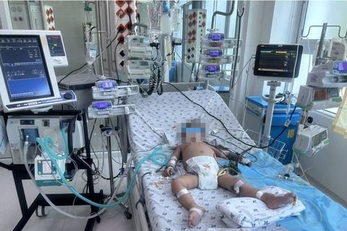 Bệnh nhi suy hô hấp, tổn thương gan nặng do sốc sốt xuất huyết