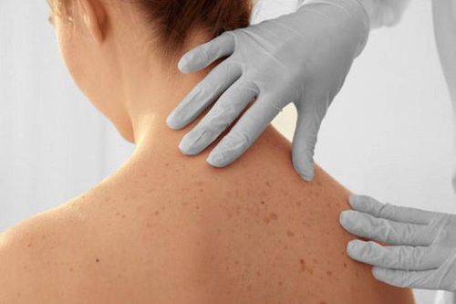 4 bất thường trên da cảnh báo ung thư