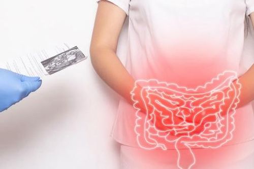 Sử dụng thuốc kháng sinh điều trị hội chứng ruột kích thích