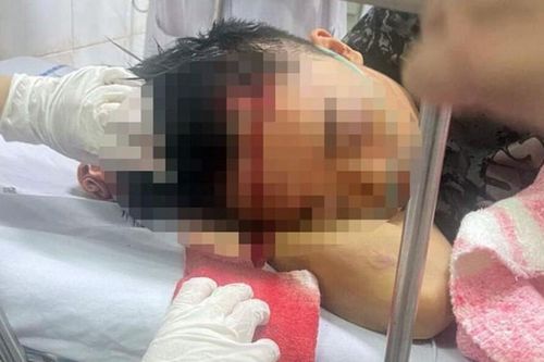 Hải Phòng: 40 thanh thiếu niên hỗn chiến náo loạn vùng quê