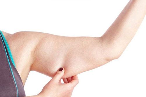5 bộ phận trên cơ thể dễ tích mỡ nhất