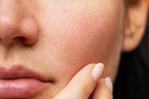 6 dấu hiệu cảnh báo cơ thể đang thiếu canxi