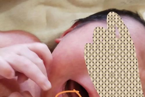Bà nội tá hỏa phát hiện cháu gái mới sinh đã mọc răng