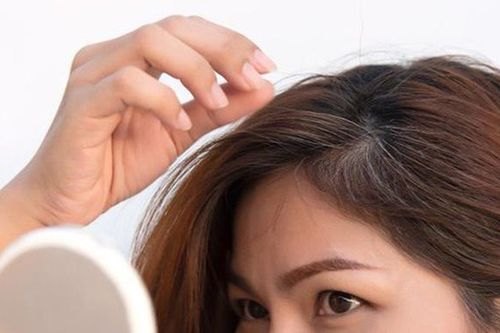 Tóc bạc chữa được không, nên nhổ bỏ hay để tự nhiên?