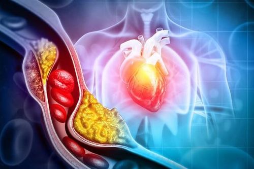 Sắp có thuốc làm giảm 60% mức cholesterol 'xấu' trong 8 tuần